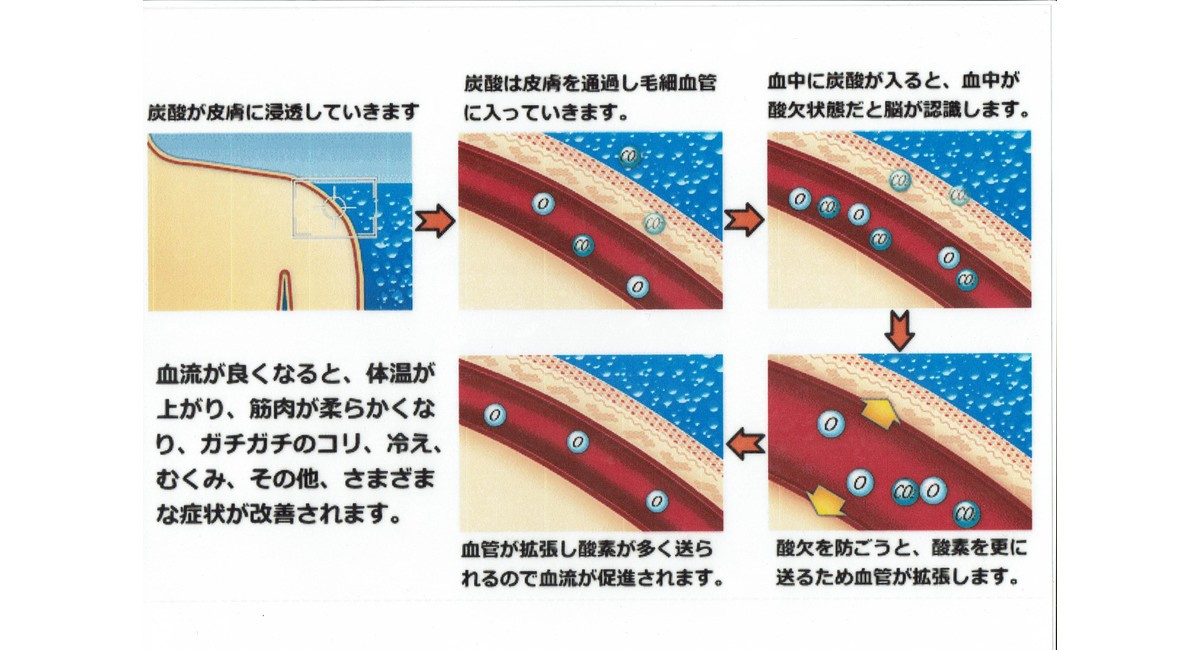 炭酸整体